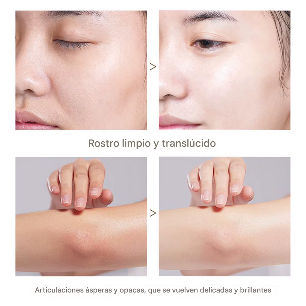 Kit Exfoliante + Crema Despigmentante